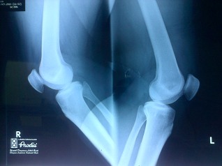 Those are my not broken bones!